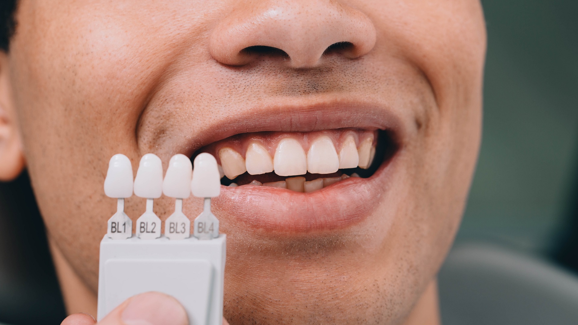 Dentist sampling shades teeth ,he holding teeth shades palette near male mouth. Whitening teeth Dentist sampling shades teeth ,he holding teeth shades palette near male mouth. Whitening teeth