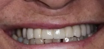 A1 - LI Dental Solutions After