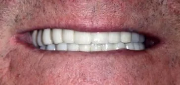 A2 - LI Dental Solutions After