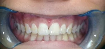 A3 - LI Dental Solutions After