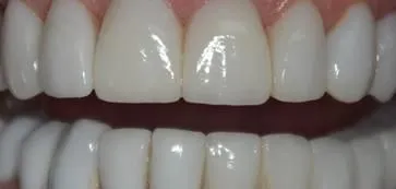 A4 - LI Dental Solutions After