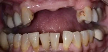 B1 - LI Dental Solutions Before