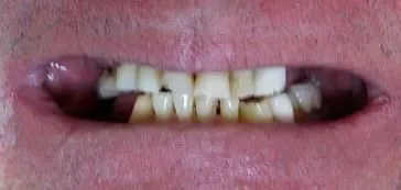 B2 - LI Dental Solutions Before