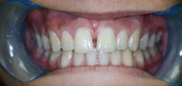 B3 - LI Dental Solutions Before