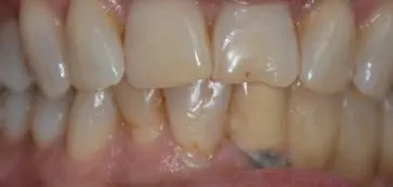 B4 - LI Dental Solutions Before