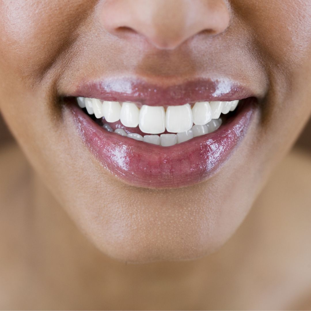 Dental Contouring near Farmingdale, NY Dental Contouring near Farmingdale, NY