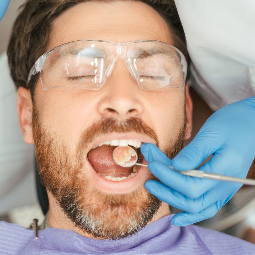 Dental Onlays and Inlays in Farmingdale Dental Onlays and Inlays in Farmingdale