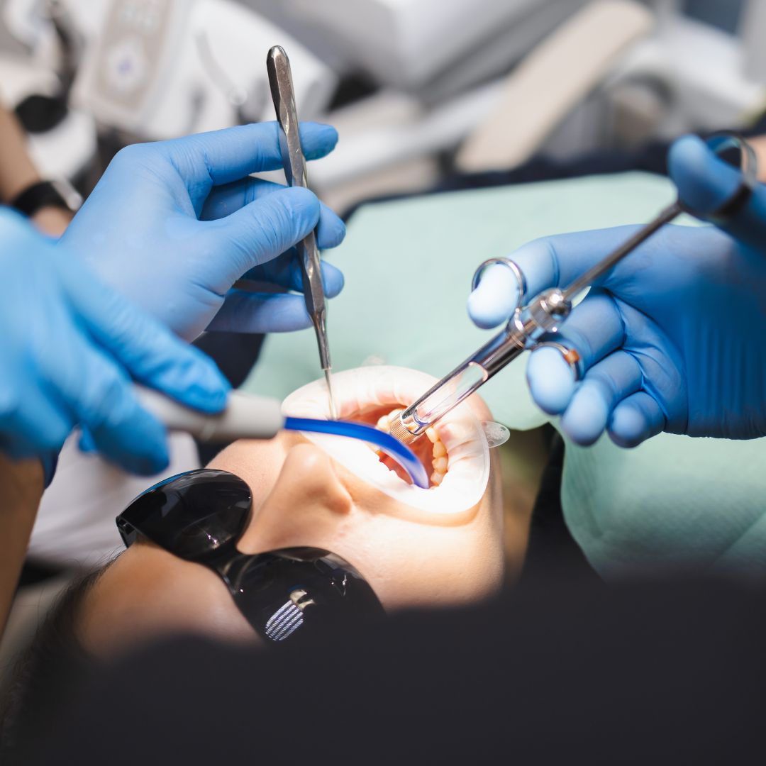 Farmingdale Crown Lengthening Farmingdale Crown Lengthening