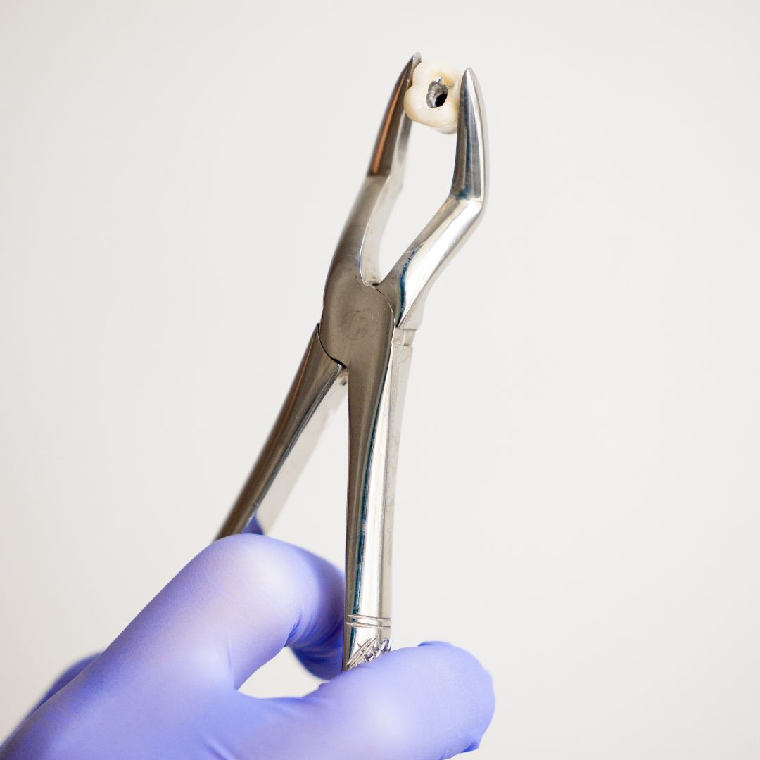 Tooth Extraction on Long Island, NY Tooth Extraction on Long Island, NY